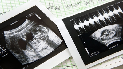 Медики призвали включить снижение абортов в критерии оценки местных властей