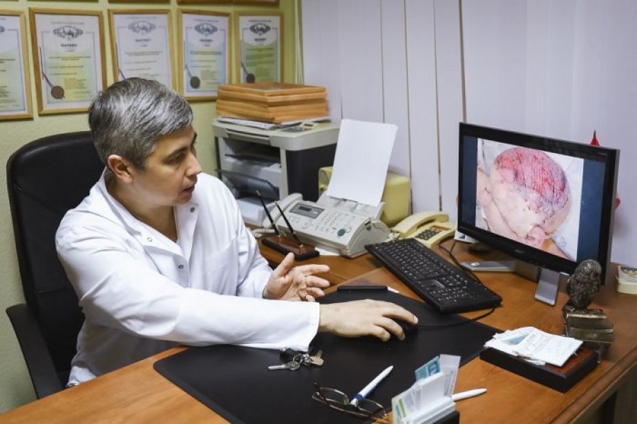 Кубанские хирурги сделали уникальную для мировой практики операцию по восстановлению скальпа