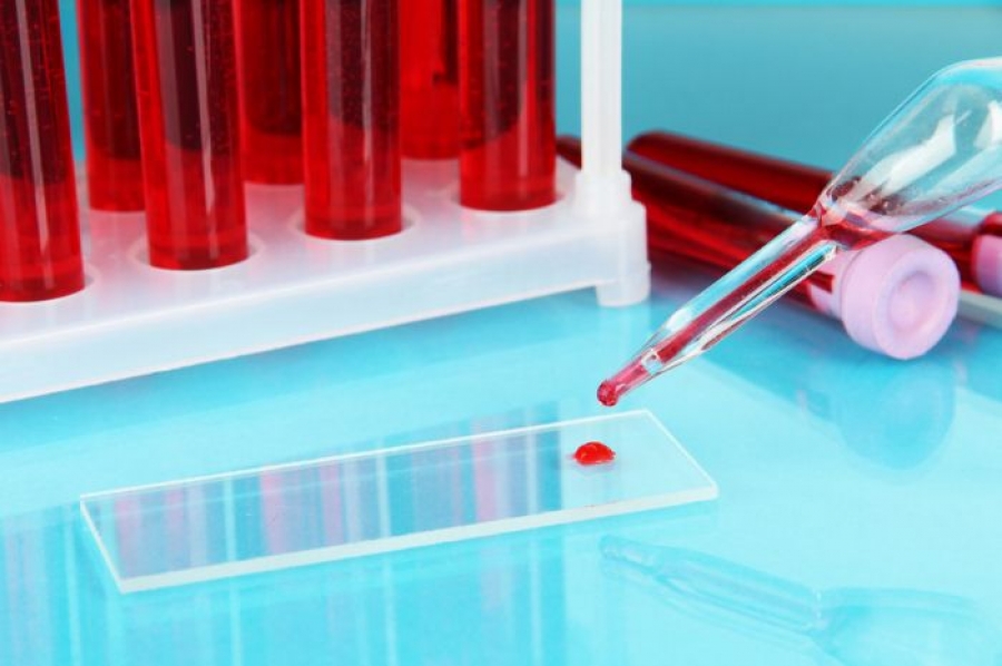 В Сеченовском университете внедряют методику диагностики рака по капле крови