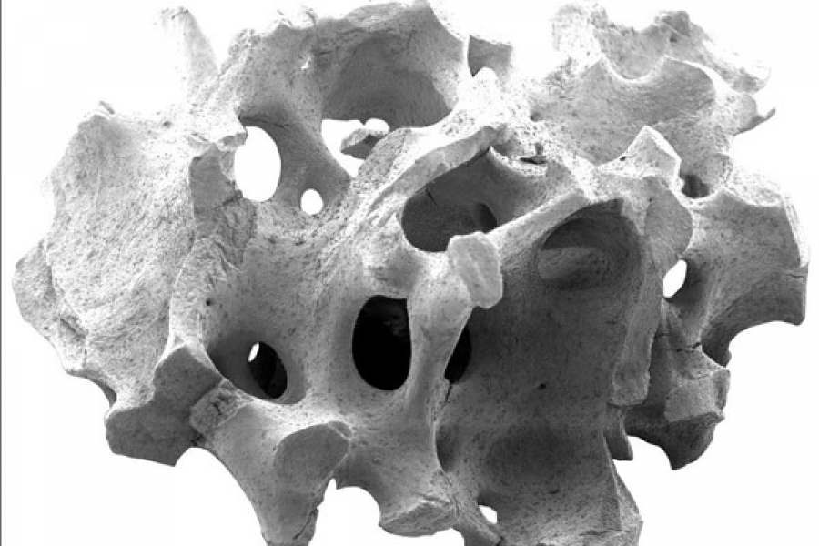 Ирландские ученые научились выращивать костную ткань с помощью нанотехнологий