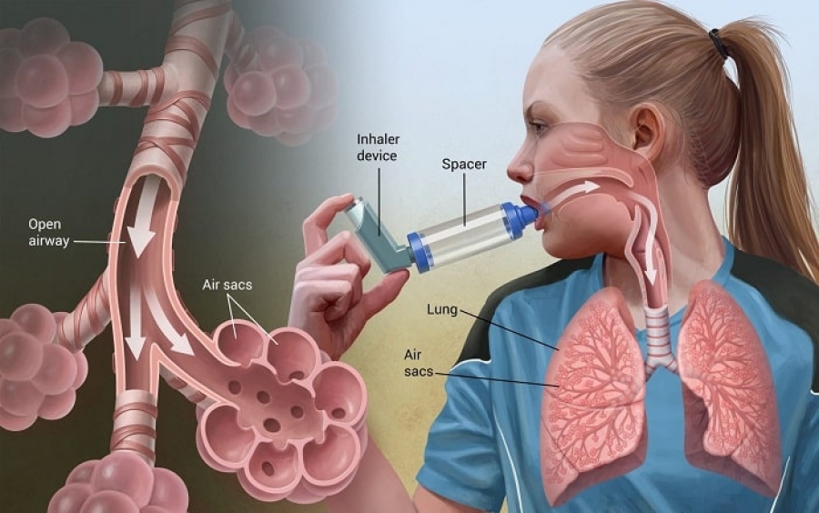 Шаг за шагом: Как лечить острую астму и свистящие хрипы у детей на первичной медико-санитарной помощи