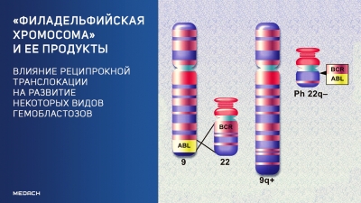 «Филадельфийская хромосома» и ее продукты: влияние реципрокной транслокации на развитие некоторых видов гемобластозов