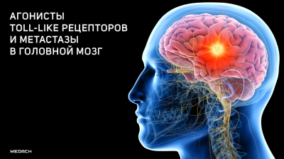 Агонисты toll-like рецепторов и метастазы в головной мозг