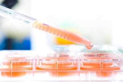 Скворцова: доклинические испытания лекарства от ВИЧ успешны