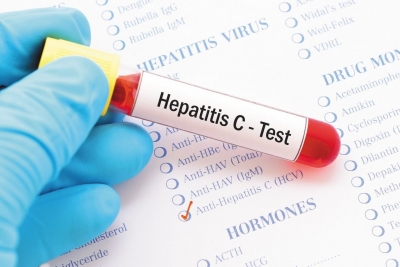 Методические рекомендации по профилактике вирусного гепатита С